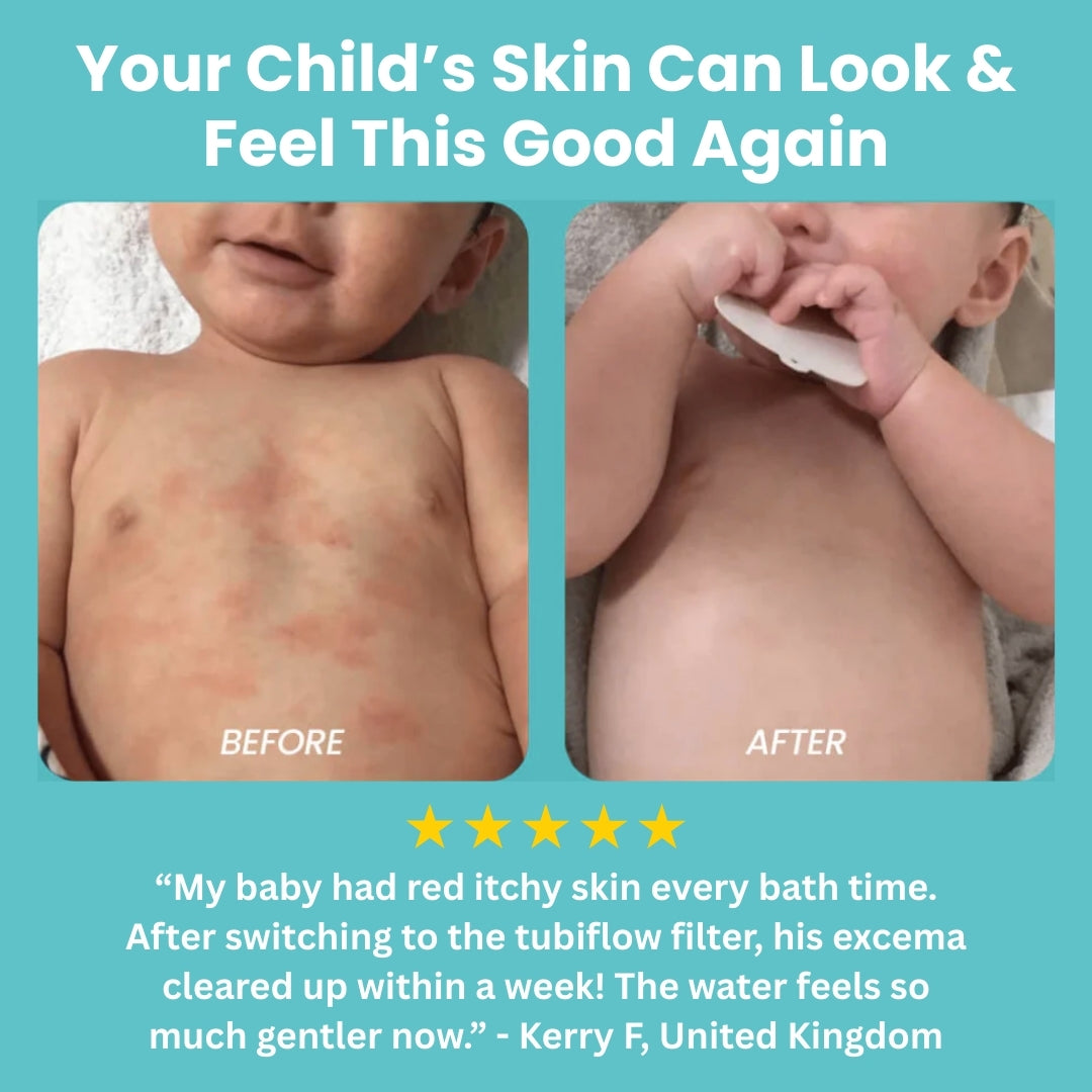 Charlies Bath Filter™ For Babies with Sensitive Skin